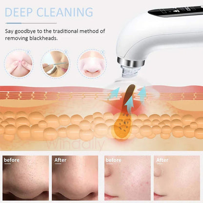 GlowJet Facial Cleaner