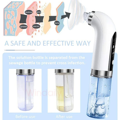 GlowJet Facial Cleaner